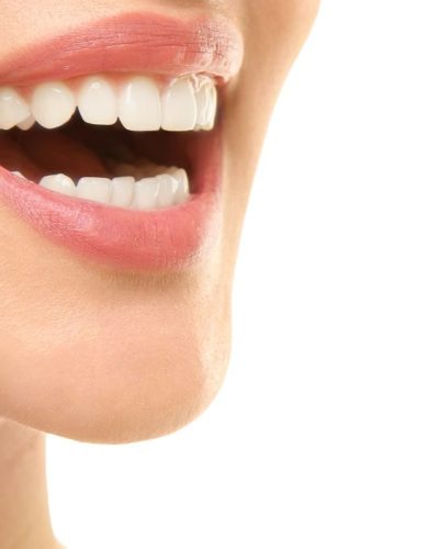 Ön Diş Zirkonya Kaplama (13)