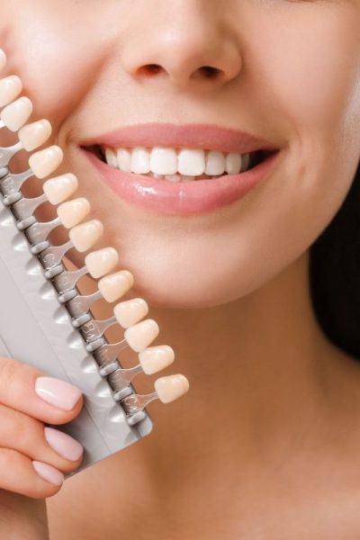 İmplant Üstü Zirkonya Diş Kaplama